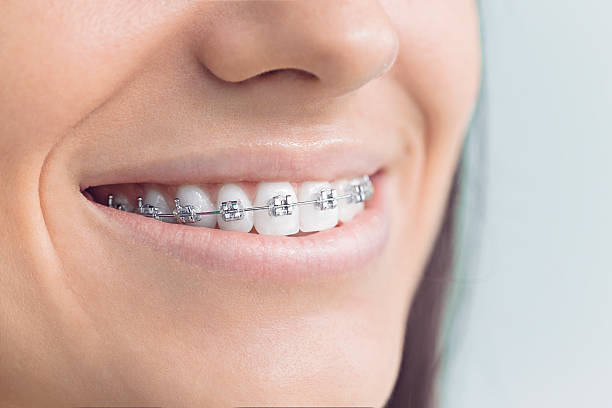 Best Veneers and Lumineers  in Monterey Park, CA